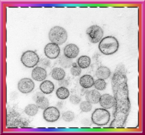 Virus epatite B
